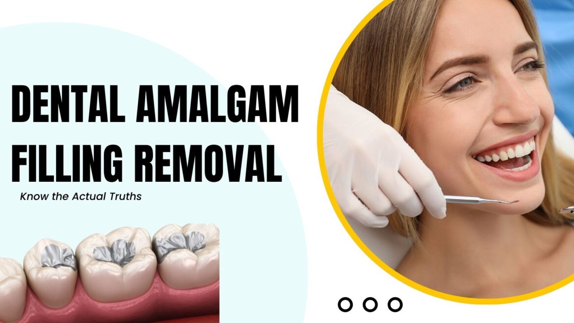 Dental Amalgam Filling Removal: Know the Actual Truths